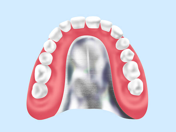 金属床……………………総入れ歯（保険適用外）